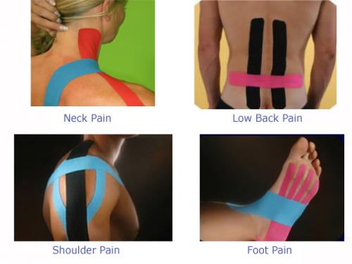Kinesio-Tex