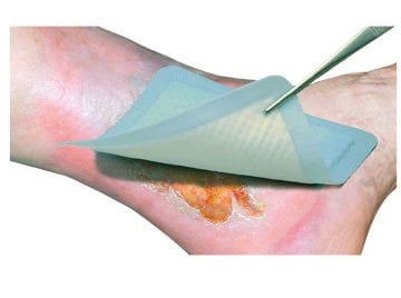 Vliwasorb Süper Emici Yara Örtüsü 10X10 CM, Yapışkansız