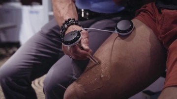 Compex Motor Point Pen Motor Nokta Kalemi