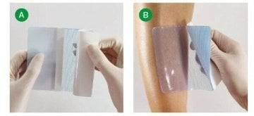 33631 Suprasorb G Jel Yara Örtüsü 10 x 10 cm 10 adet %10 iskontolu