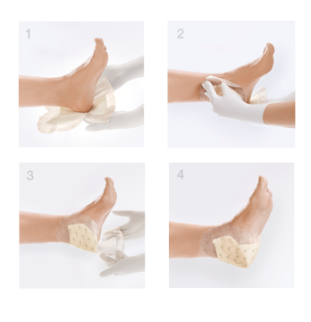 Lohmann Rauscher Suprasorb P Sensitive Silikon Yara Örtüsü Topuk 139356 Suprasorb P Sensitive 23.5 x 25 cm